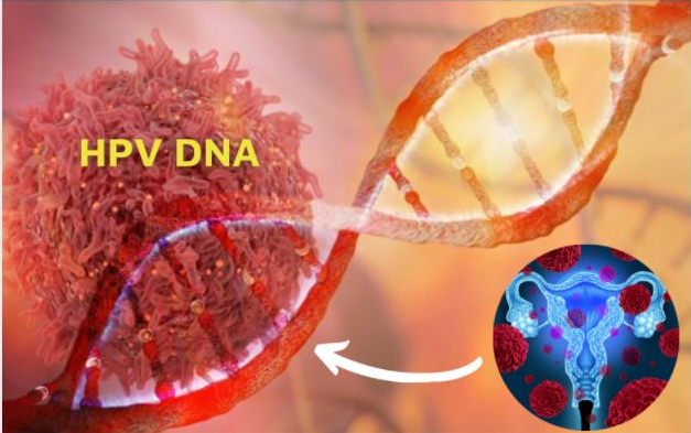 Xét nghiệm DNA HPV