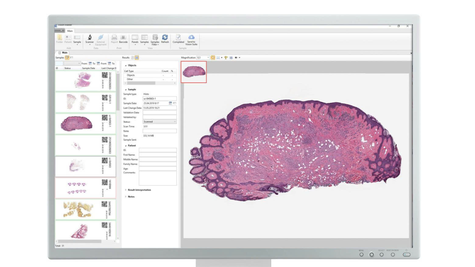 Nikon Automated slide analysis systems