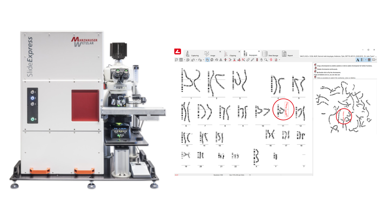 Nikon Microscopes for genetics and cytogenetics