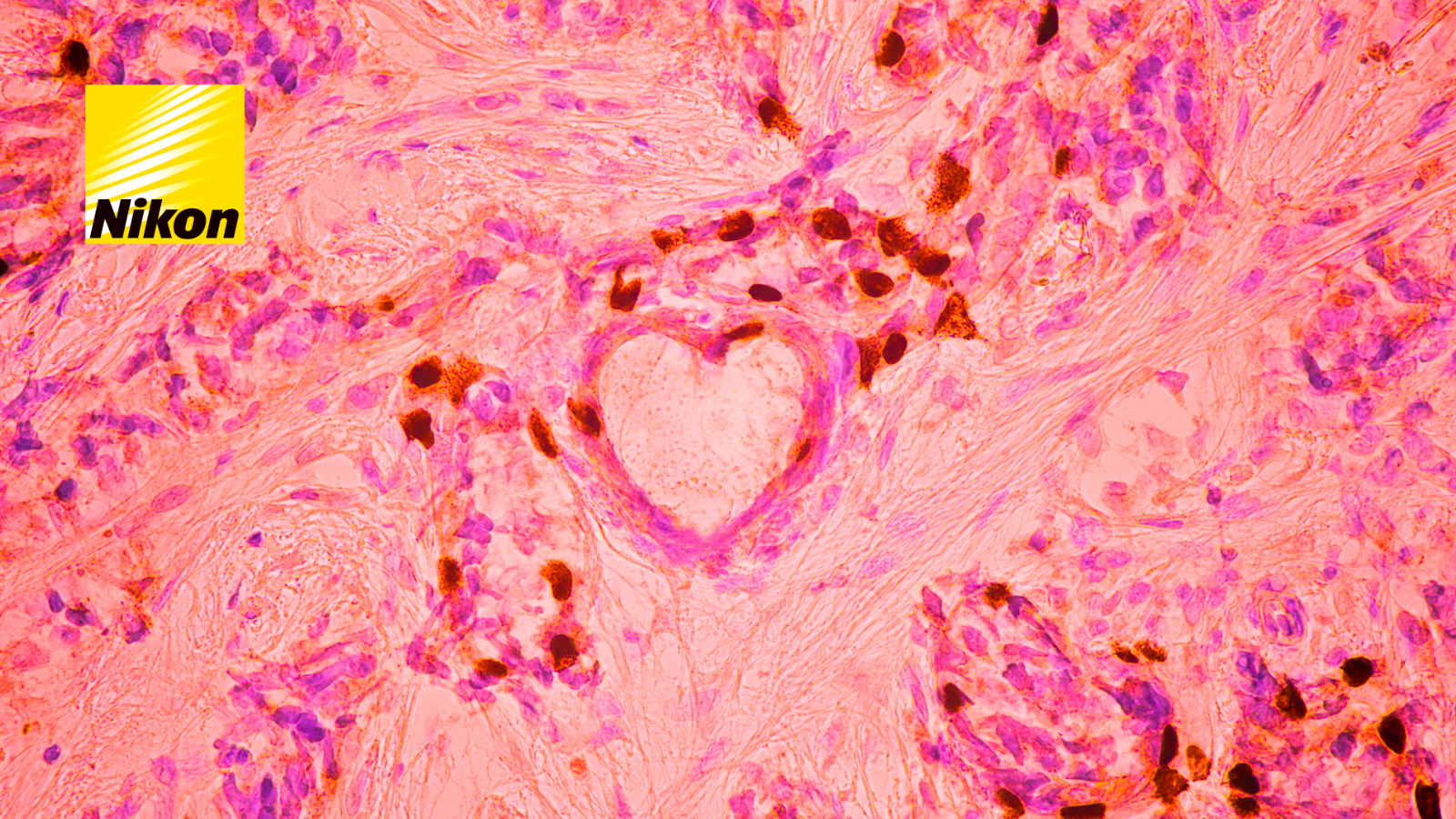 Nikon Microscopes for histopathology