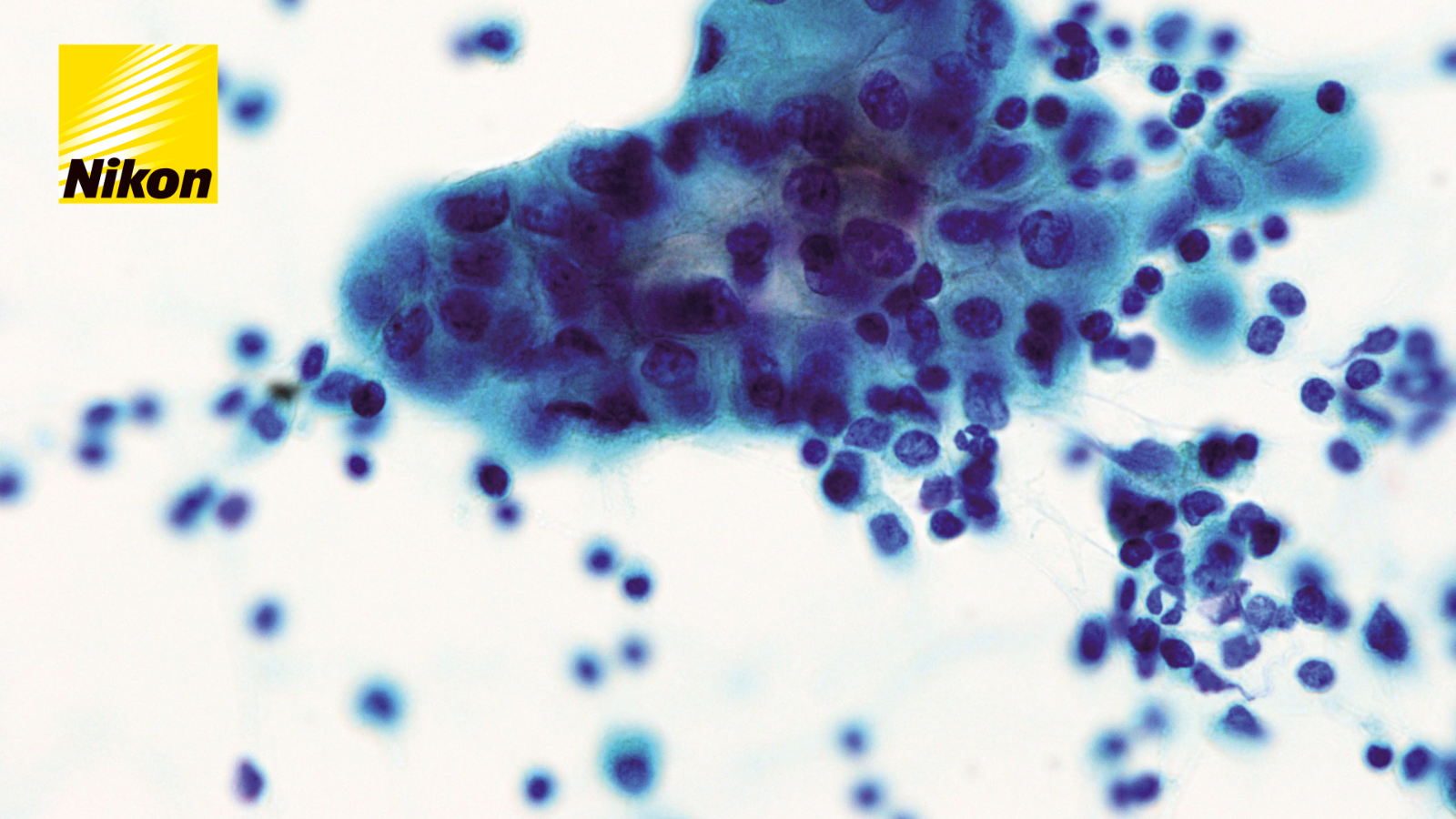 Nikon Microscopes for hematology and cellular diagnostics