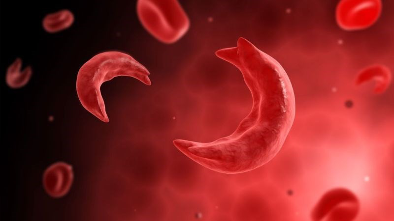 Rối loạn Hemoglobin