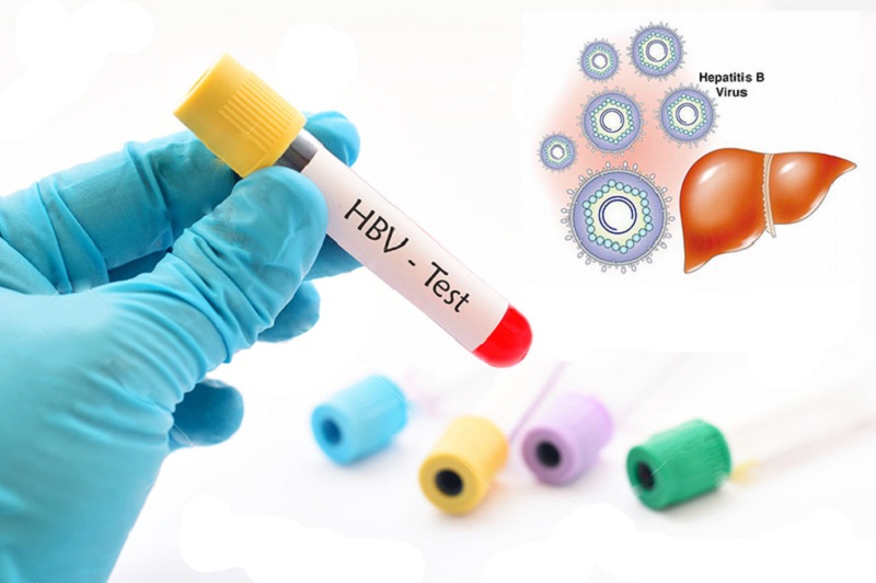 Xét nghiệm nhanh kháng nguyên HbsAg chẩn đoán viêm gan B