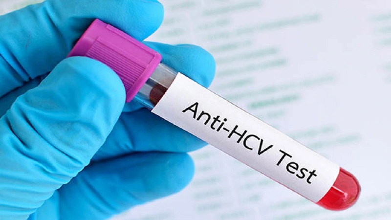 Xét nghiệm nhanh kháng thể kháng HCV chẩn đoán viêm gan C