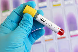 Xét nghiệm miễn dịch bệnh truyền nhiễm (HBV, HCV, HIV, STIs,…)