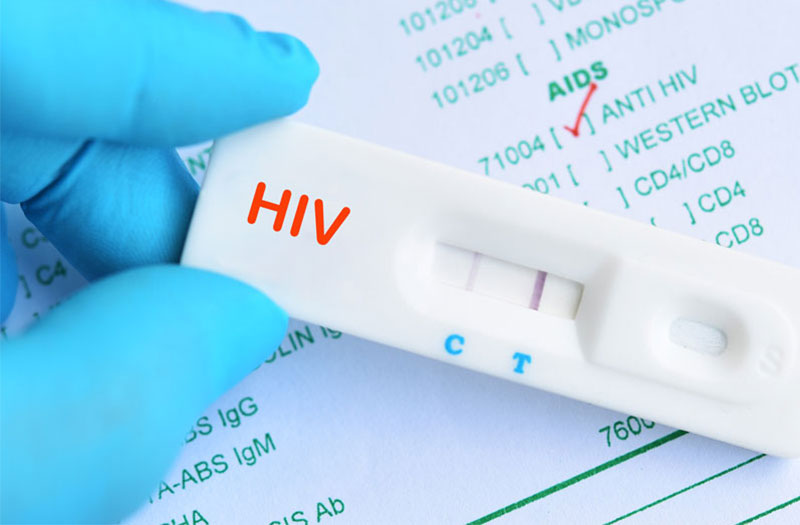 Xét nghiệm nhanh HIV
